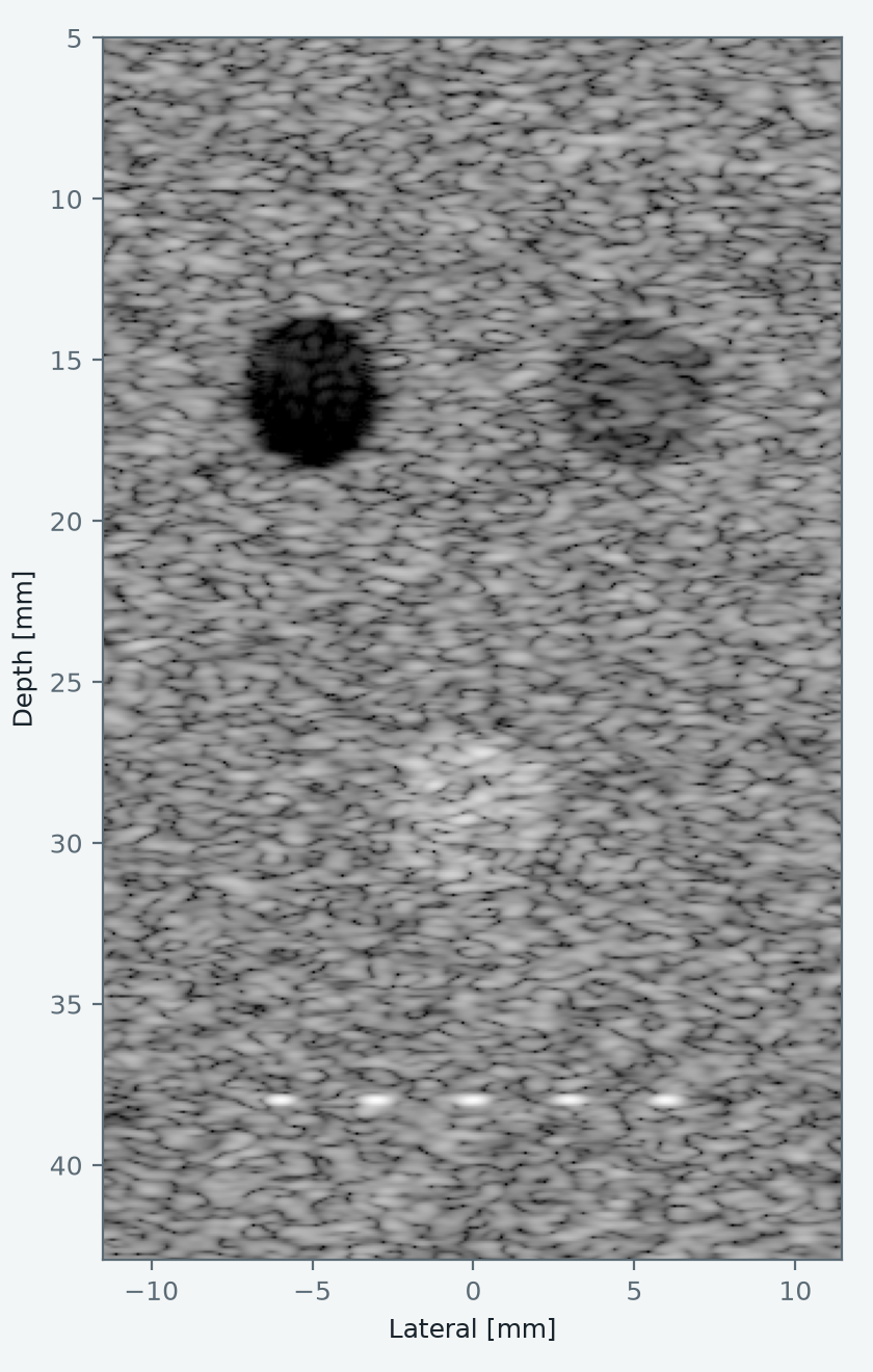 Simulated B-mode image with an anechoic cyst, two lesions and a row of wire targets