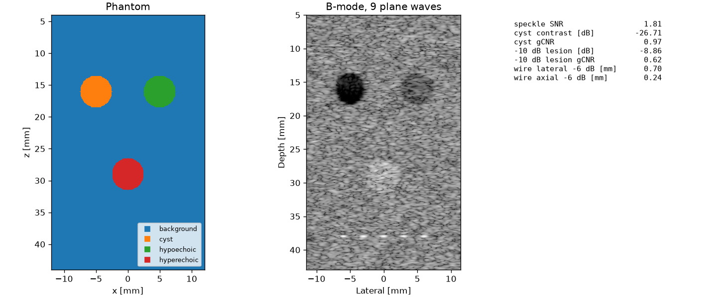 Phantom label map, simulated B-mode image with a cyst, two lesions and wire targets, and image quality measures