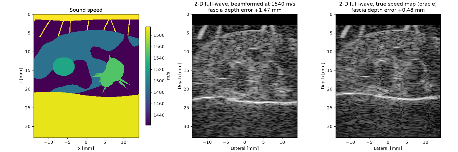 Sound speed of a breast phantom and 2-D full-wave images beamformed at 1540 m/s and through the true speed map, with the depth error of the fascia