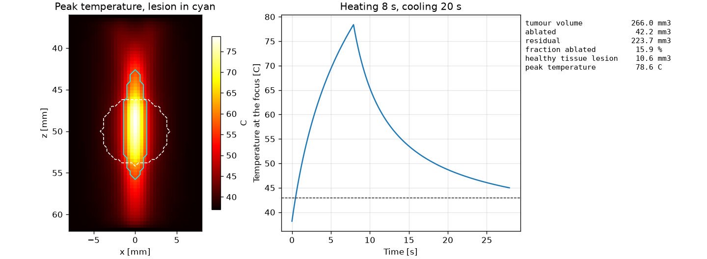 Peak temperature around a focused ultrasound exposure with the lesion outline, temperature at the focus and the treatment report